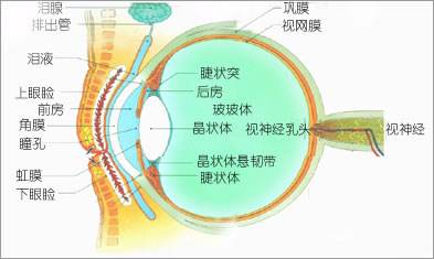 為什么會(huì)發(fā)展成高度近視？